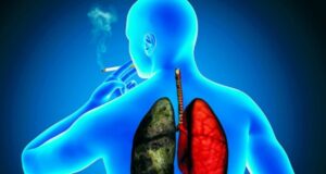 cáncer de pulmón